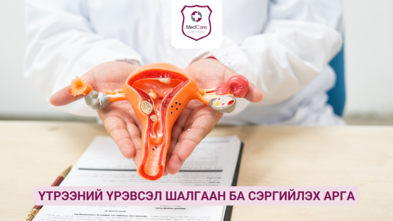 Үтрээний үрэвсэл