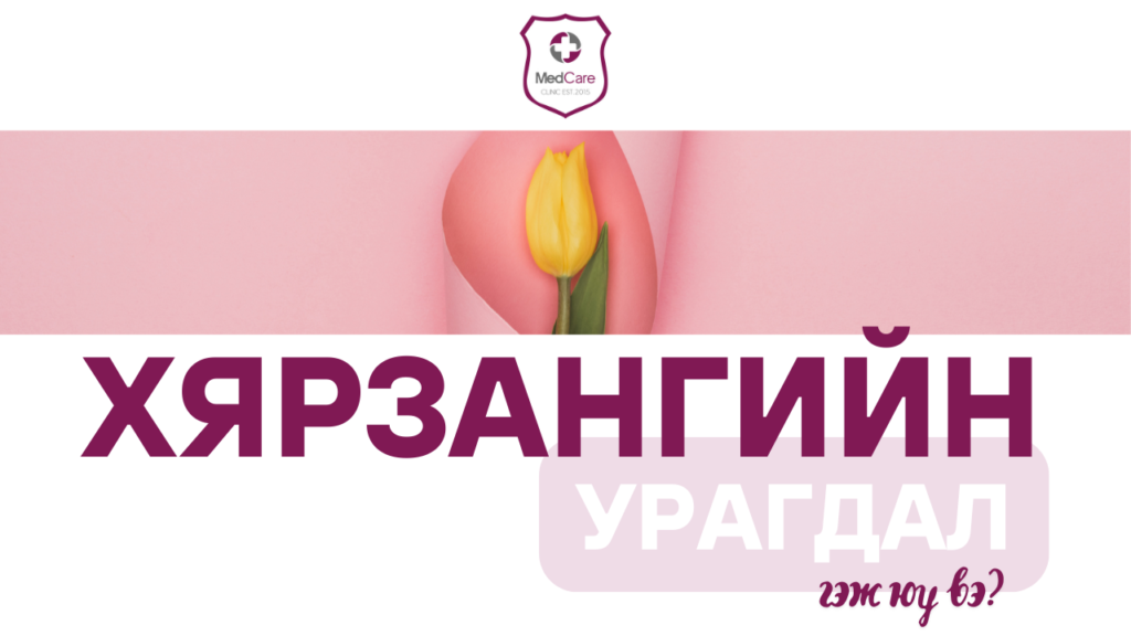 Хярзангийн урагдал