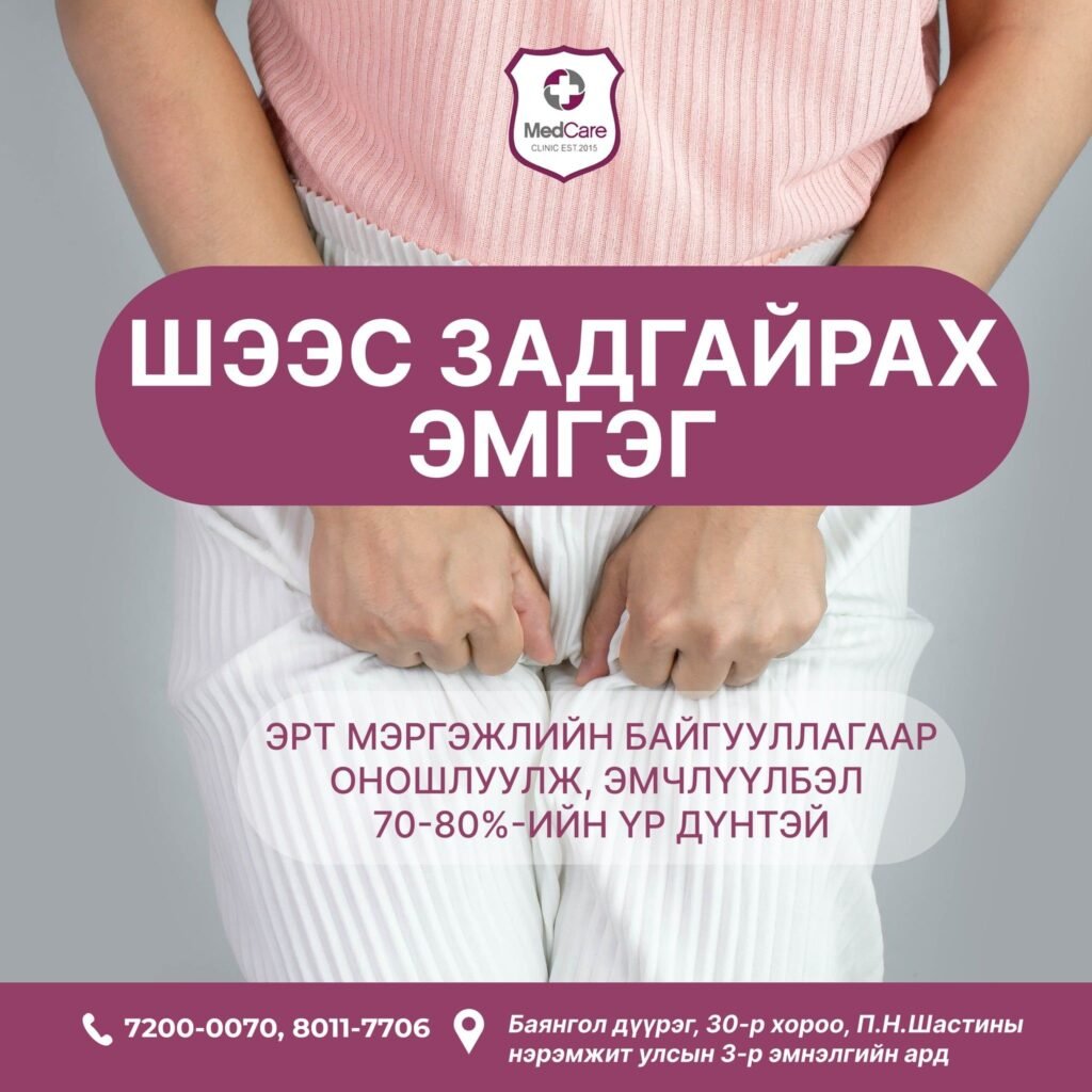 шээс задгайрах